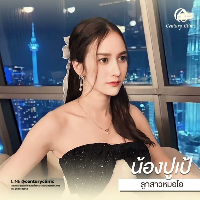 Century-รีวิว-เสริมจมูก #653