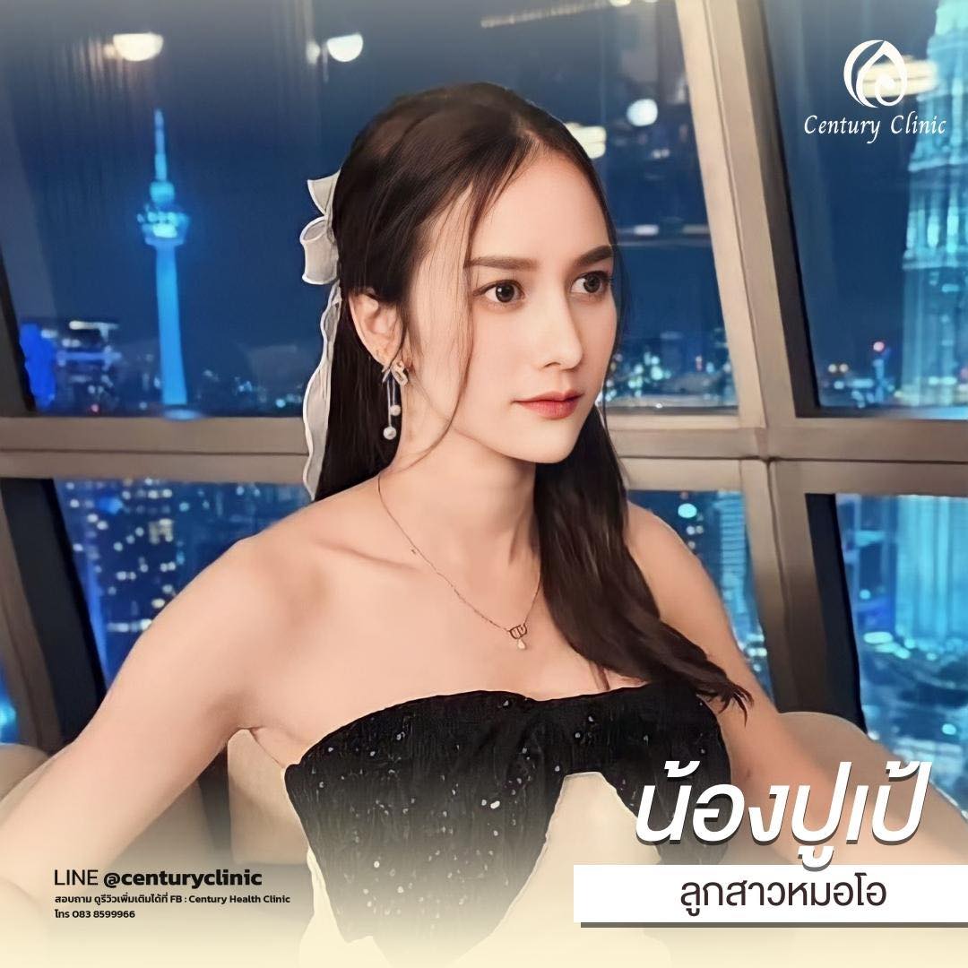 Century-รีวิว-เสริมจมูก #653