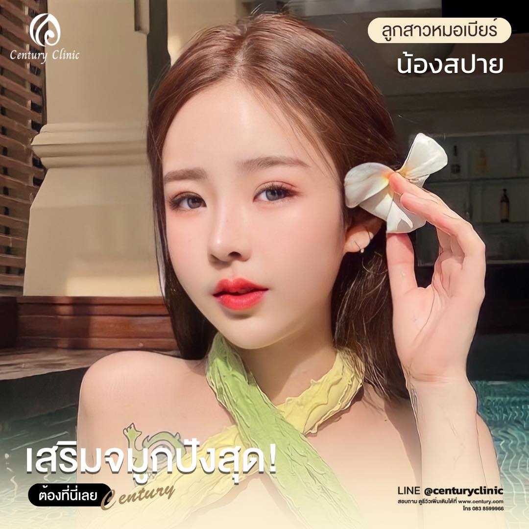 Century-รีวิว-เสริมจมูก #654