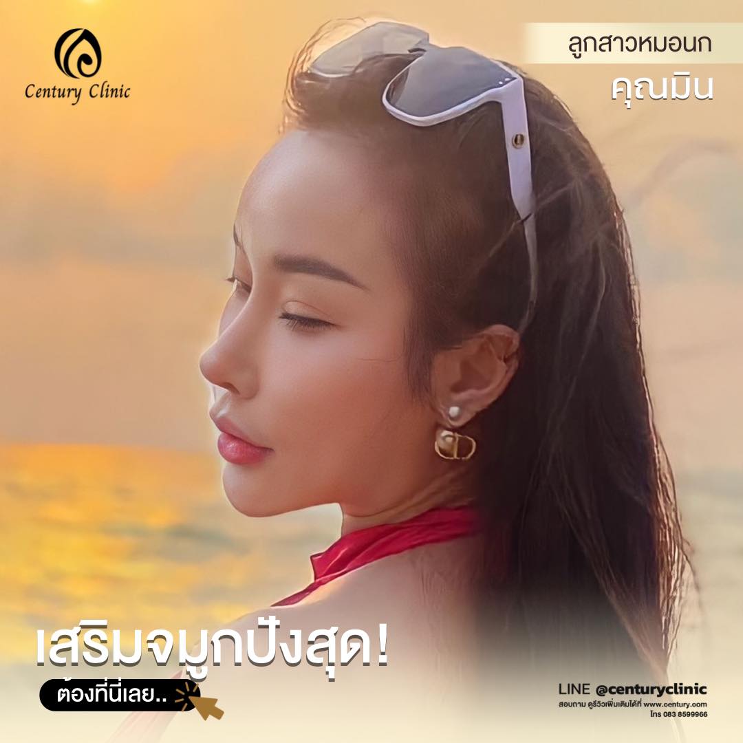 Century-รีวิว-เสริมจมูก #657