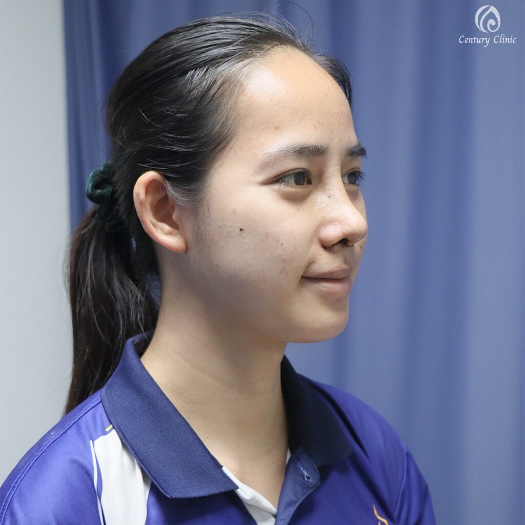 Century-รีวิว-แก้จมูก 1#659