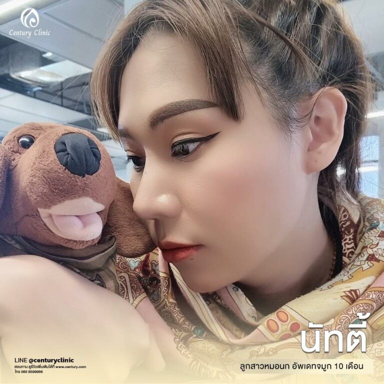 Century-รีวิว-แก้จมูก #632