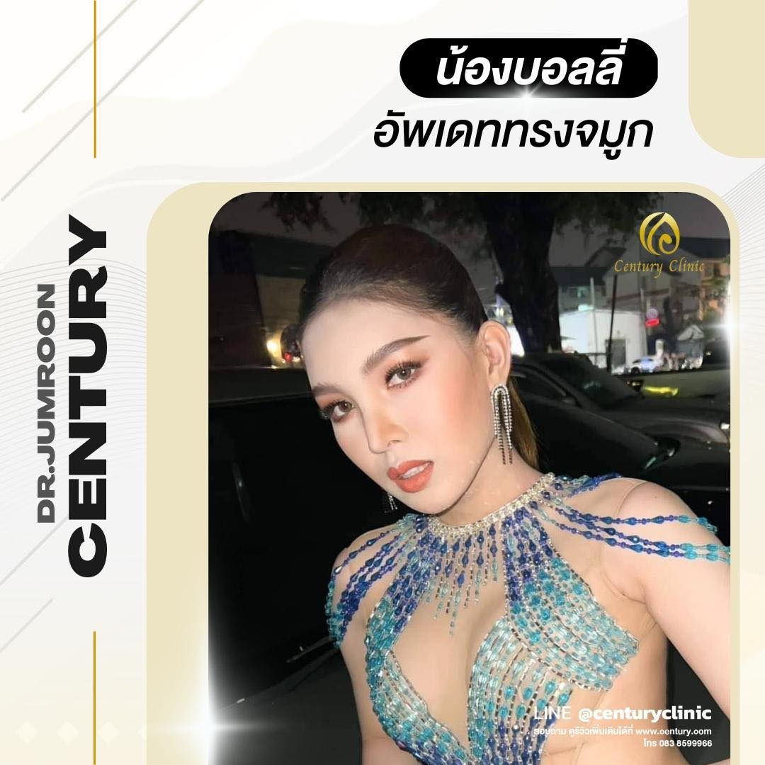 รีวิว แก้จมูก #646 , Century Clinic Thailand Century-รีวิว-แก้จมูก #646