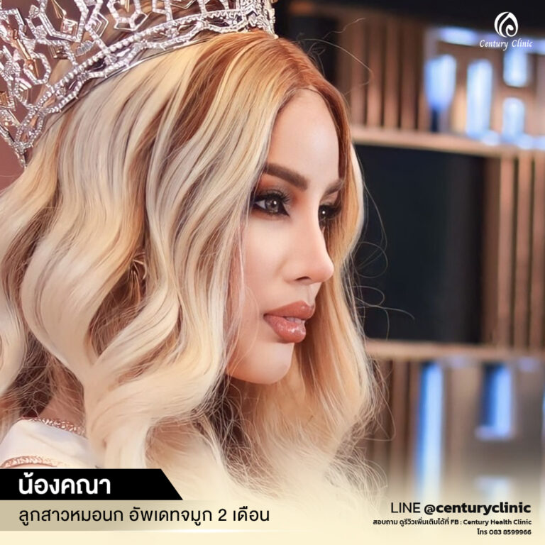 Century-รีวิว-แก้จมูก #650