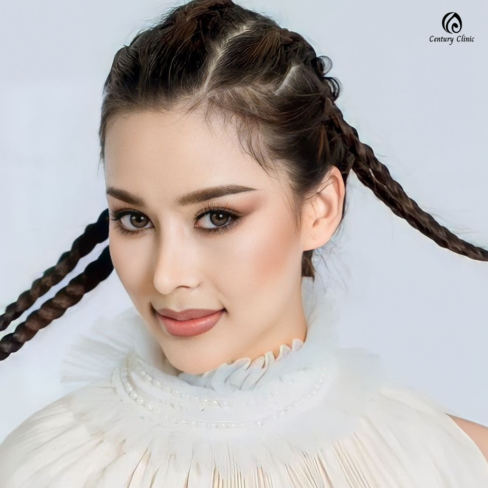 รีวิว เสริมจมูก #670 , Century Clinic Thailand Century-รีวิว-เสริมจมูก 1#670