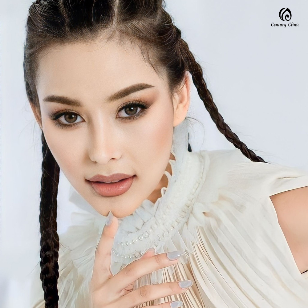 รีวิว เสริมจมูก #670 , Century Clinic Thailand Century-รีวิว-เสริมจมูก 2#670