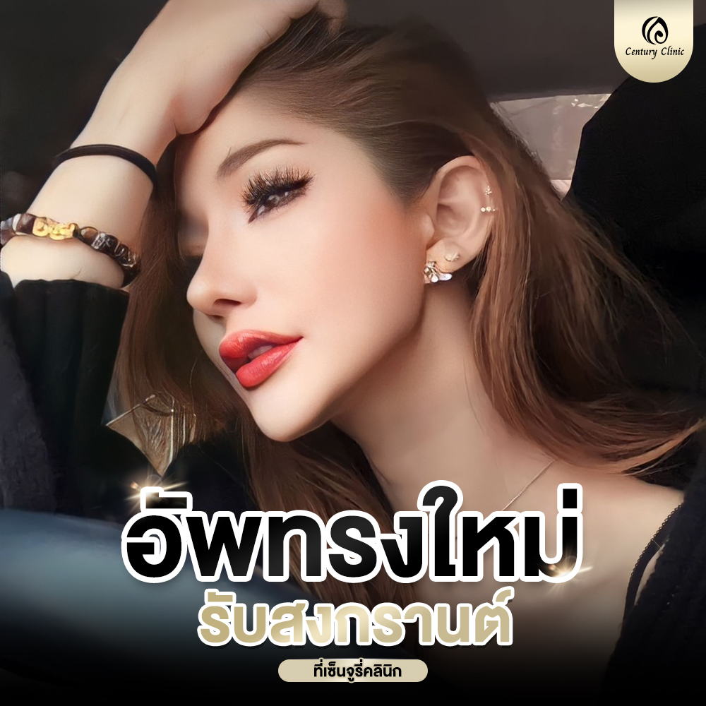 รีวิว เสริมจมูก #669 , Century Clinic Thailand Century-รีวิว-เสริมจมูก #669