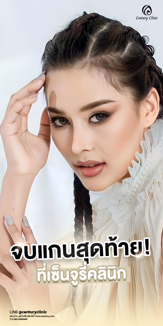 รีวิว เสริมจมูก #670 , Century Clinic Thailand Century-รีวิว-เสริมจมูก #670