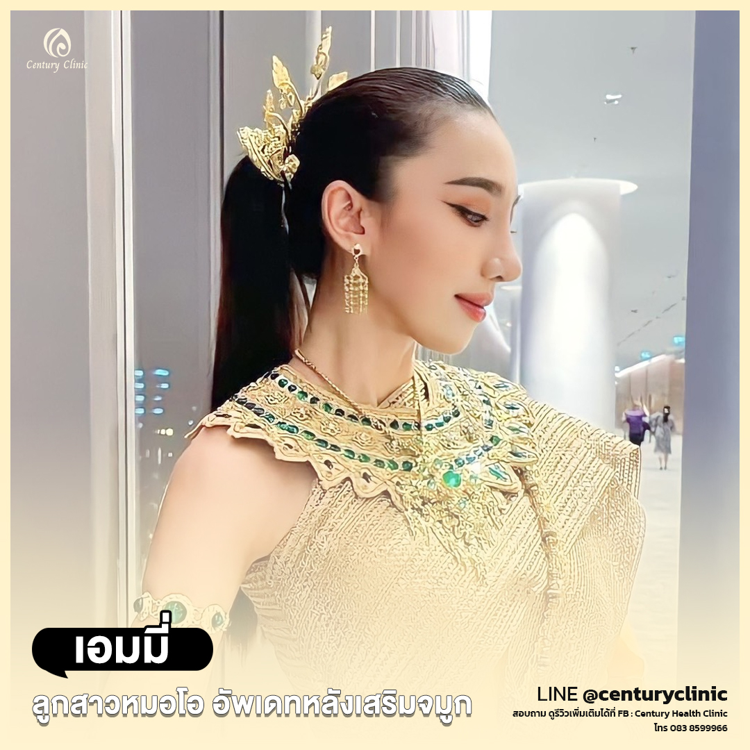 Century-รีวิว-เสริมจมูก #672