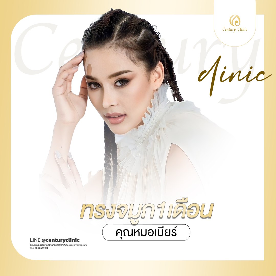 Century-รีวิว-เสริมจมูก #682