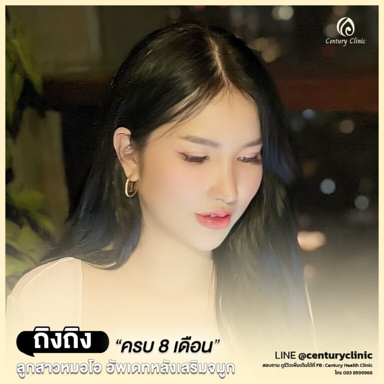 Century-รีวิว-เสริมจมูก #692