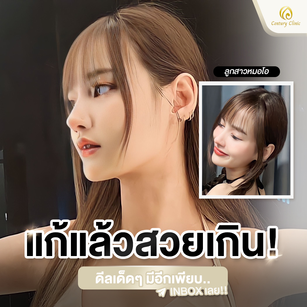 Century-รีวิว-แก้จมูก #663
