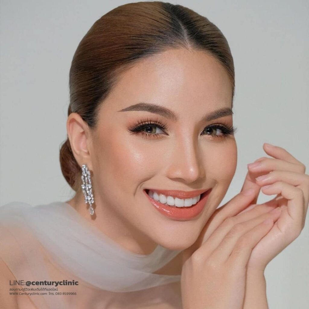 Century-รีวิว-เสริมจมูก 2#706