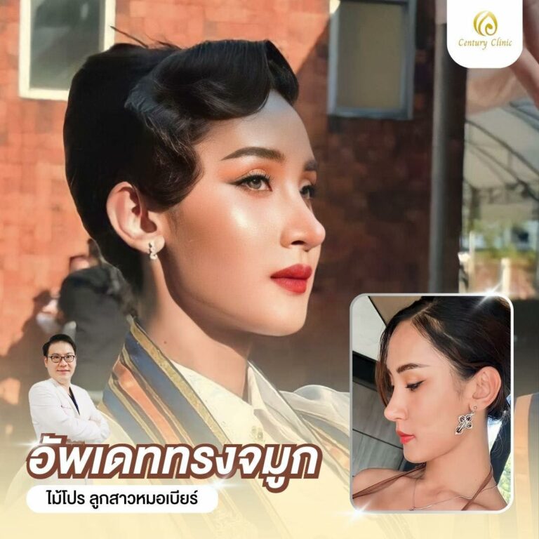 Century-รีวิว-เสริมจมูก #694