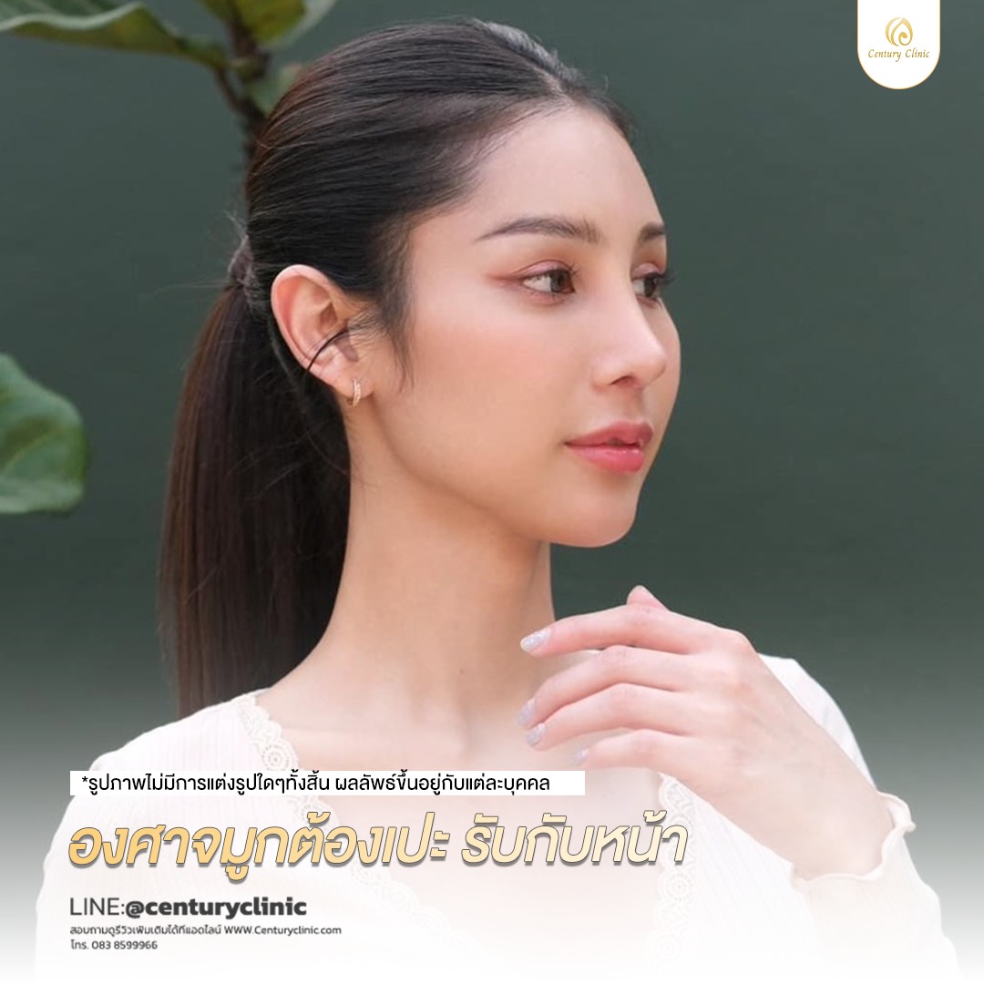 รีวิว แก้จมูก #695 , Century Clinic Thailand Century-รีวิว-แก้จมูก #695