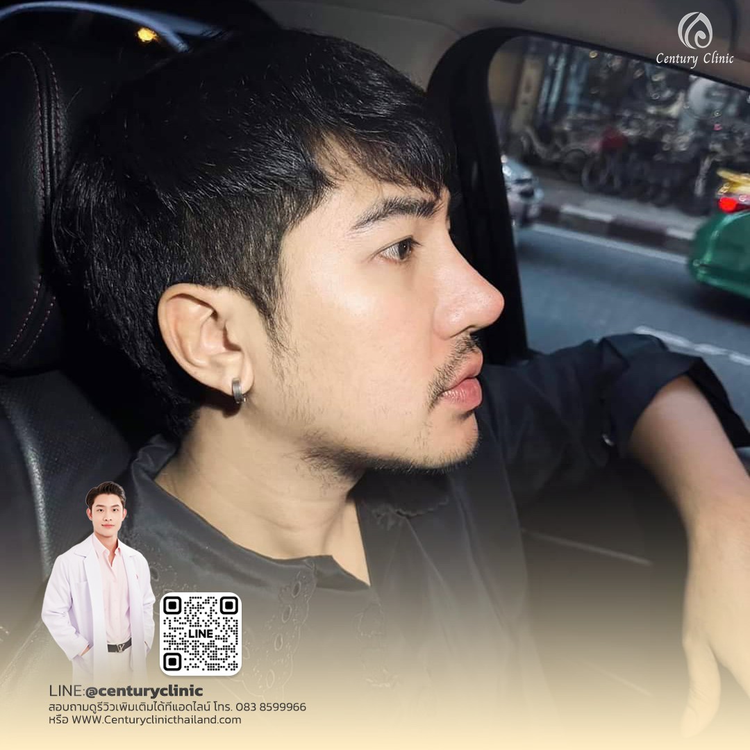 Century-รีวิว-แก้จมูก #713