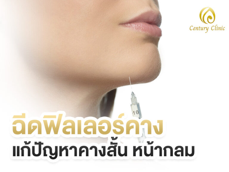ฉีดฟิลเลอร์คาง แก้ปัญหาคางสั้น หน้ากลม