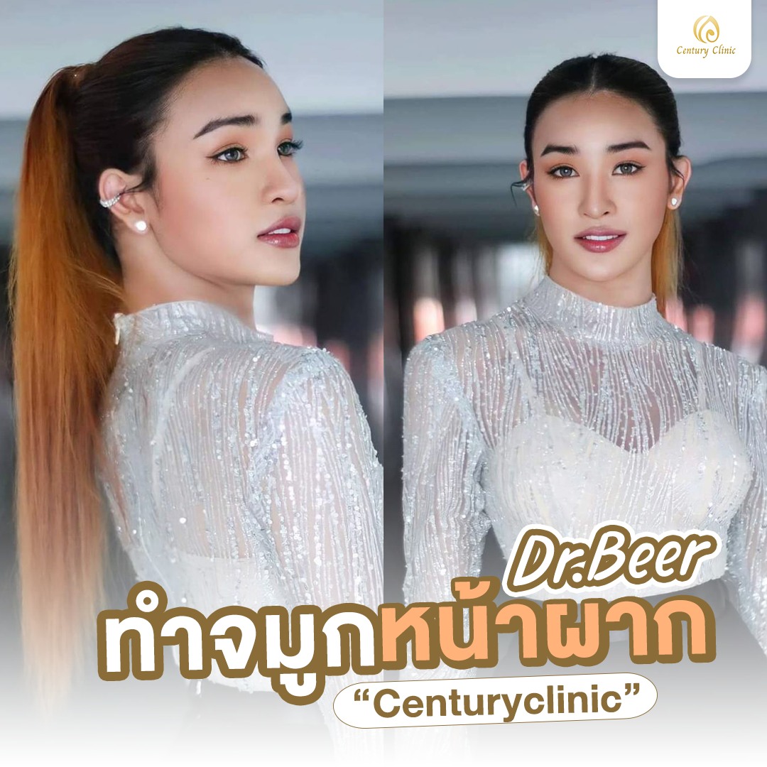 Century-รีวิว-เสริมจมูก #747