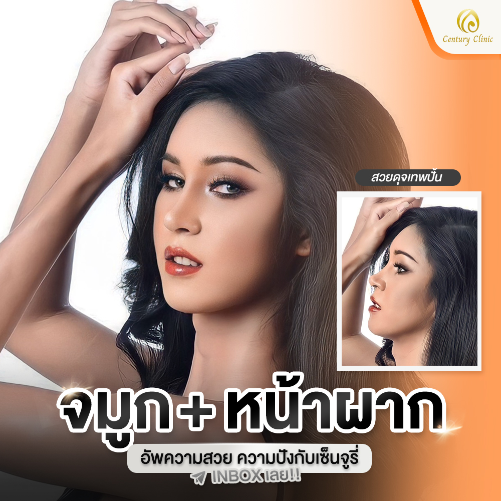 รีวิว เสริมจมูก #765 , Century Clinic Thailand Century-รีวิว-เสริมจมูก #765