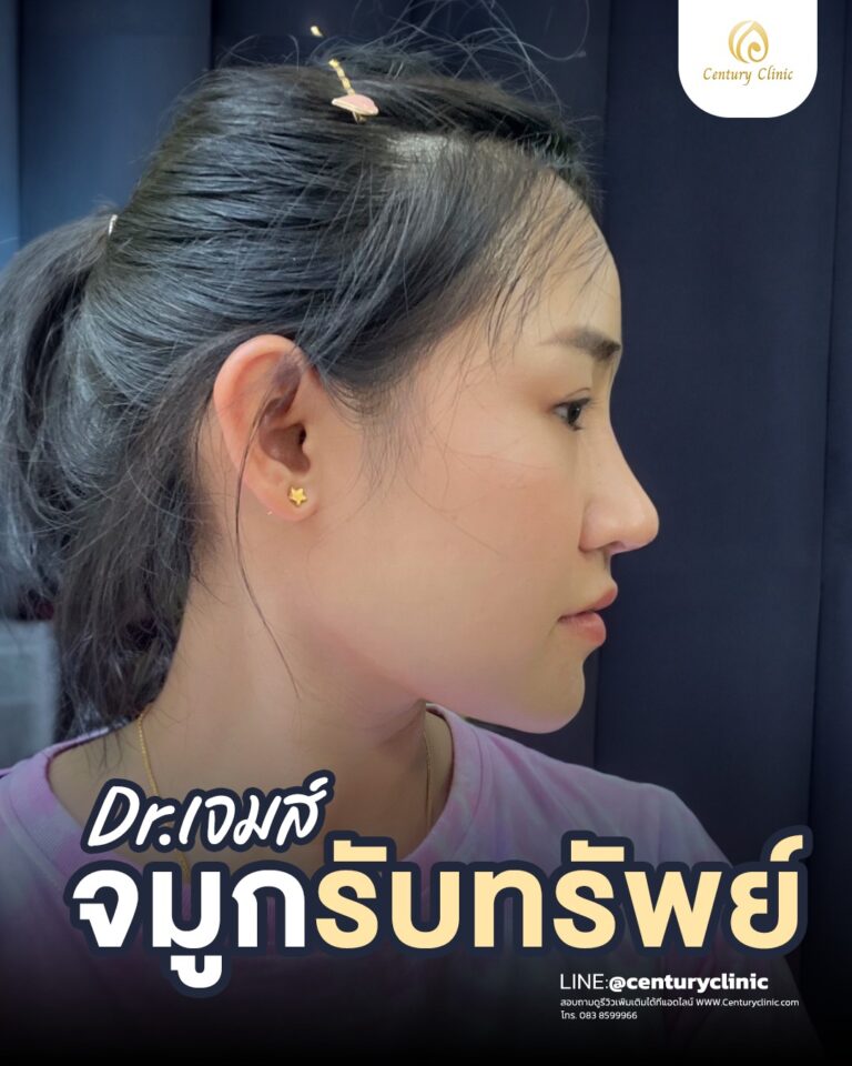 Century-รีวิว-แก้จมูก #737
