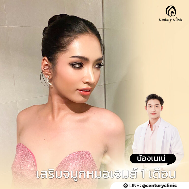 Century-รีวิว-แก้จมูก #741
