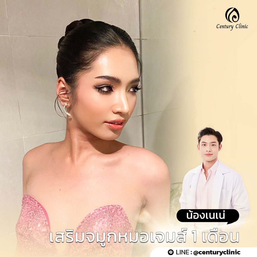 รีวิว แก้จมูก #741 , Century Clinic Thailand Century-รีวิว-แก้จมูก #741