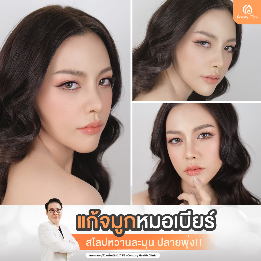 รีวิว แก้จมูก #752 , Century Clinic Thailand Century-รีวิว-แก้จมูก #752