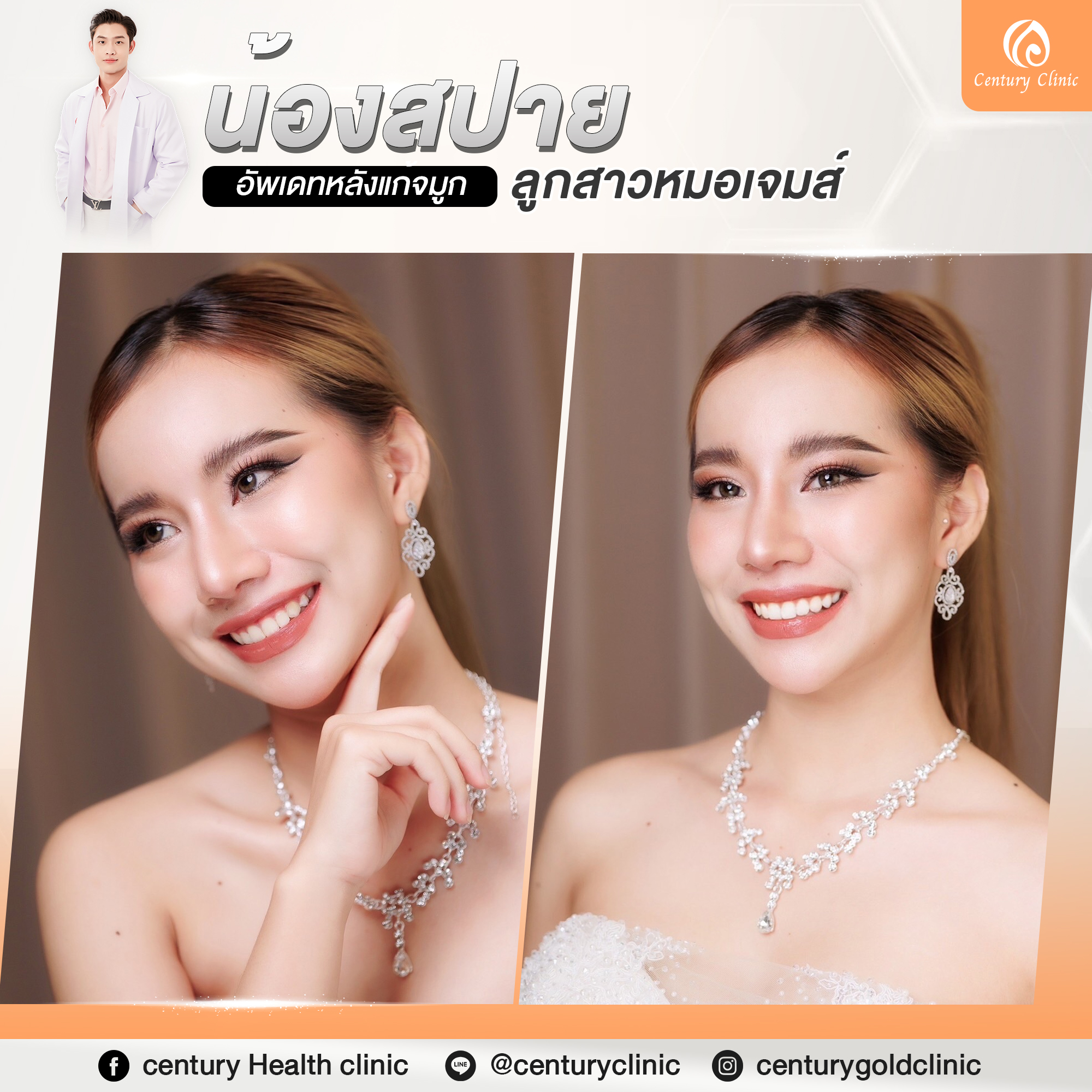 Century-รีวิว-แก้จมูก #766
