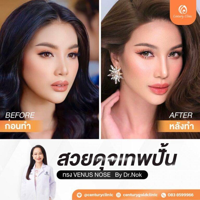 Century-รีวิว-แก้จมูก #767