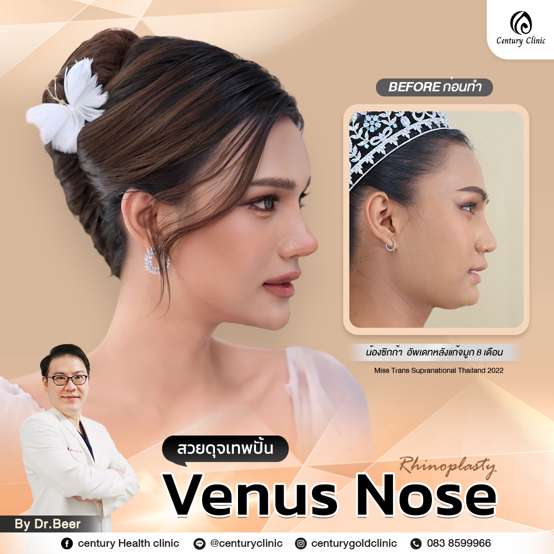 Century-รีวิว-แก้จมูก #772