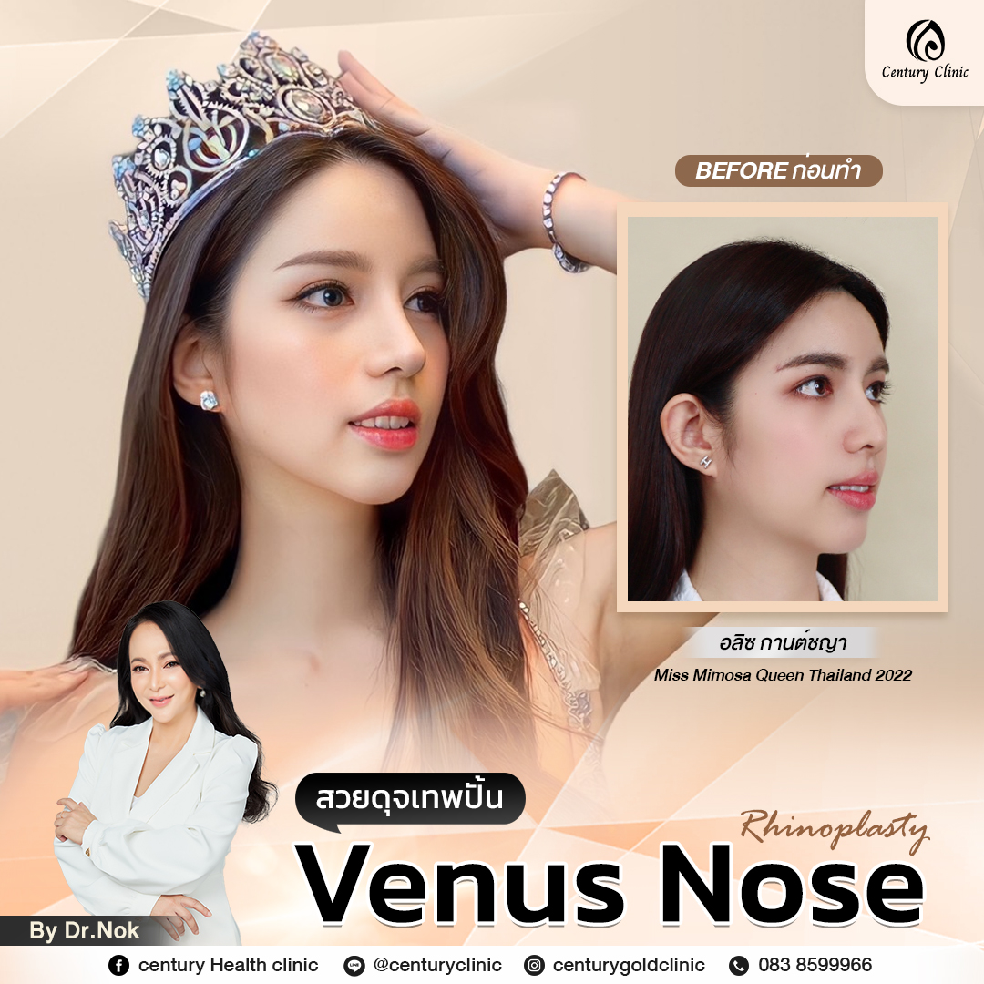 รีวิว แก้จมูก #774 , Century Clinic Thailand Century-รีวิว-แก้จมูก #774