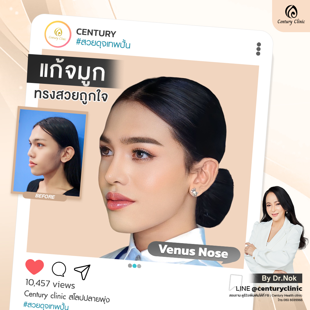 Century-รีวิว-แก้จมูก #775