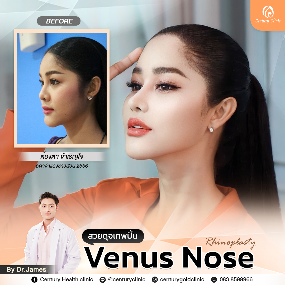 Century-รีวิว-แก้จมูก #778