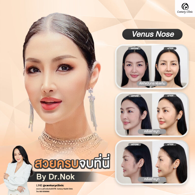Century-รีวิว-แก้จมูก #779