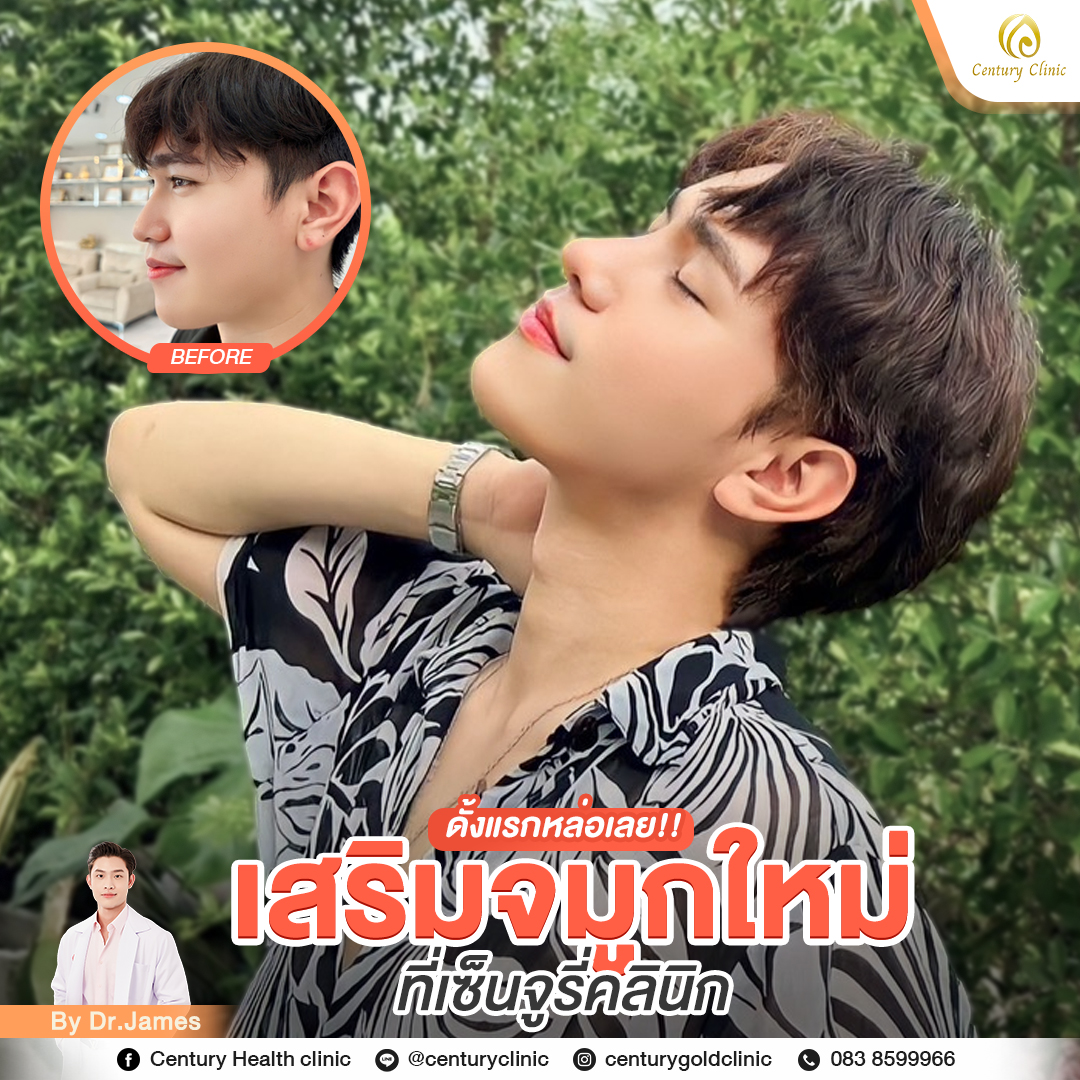 รีวิว เสริมจมูก #785 , Century Clinic Thailand Century-รีวิว-เสริมจมูก #785