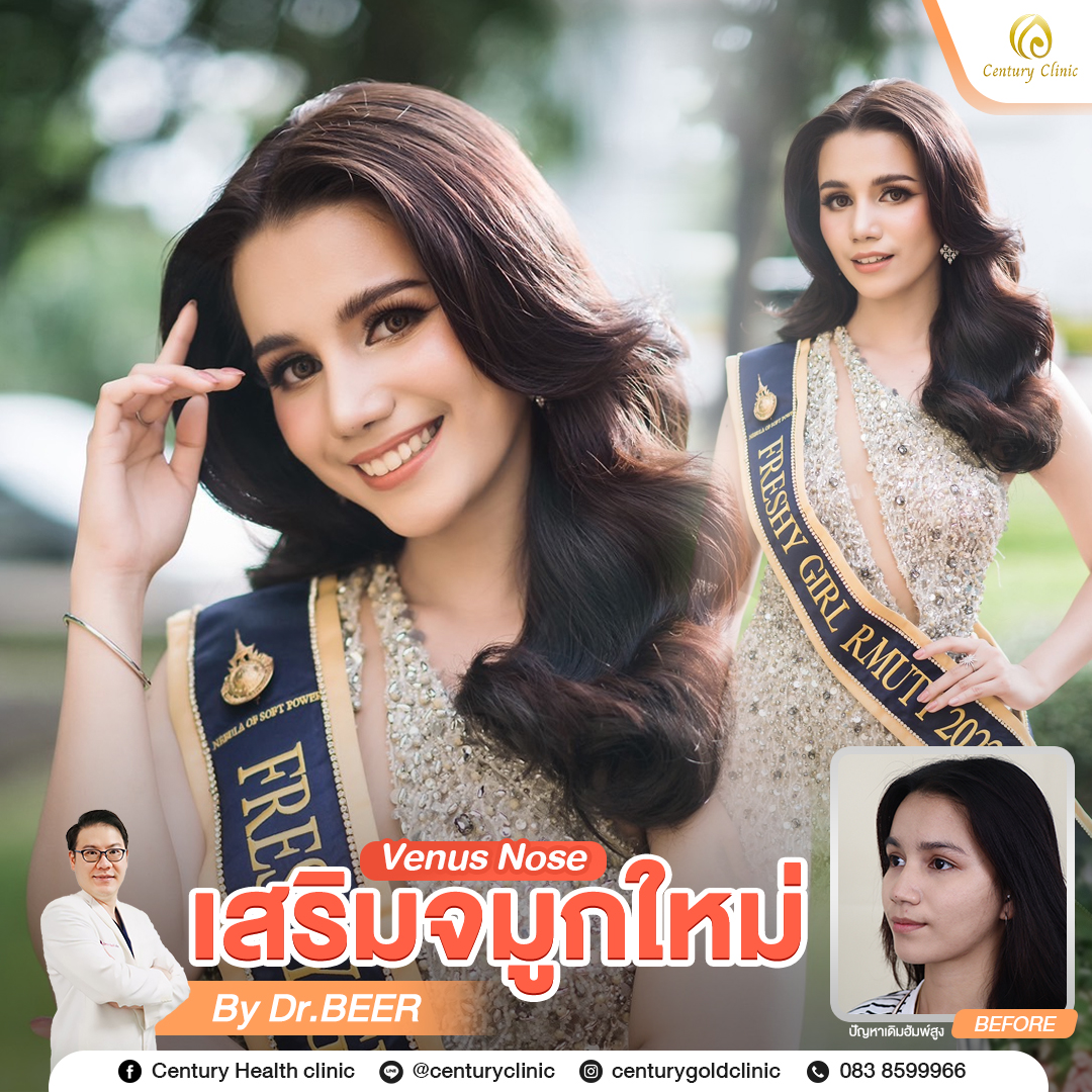Century-รีวิว-เสริมจมูก #795