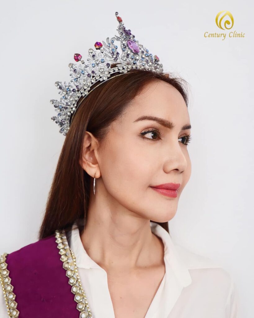 รีวิว แก้จมูก #787 , Century Clinic Thailand Century Clinic Thailand