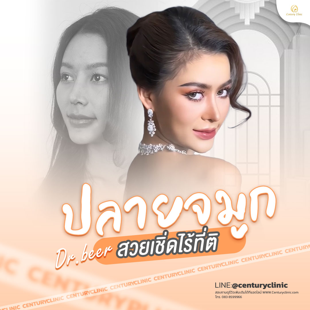 รีวิว แก้จมูก #783 , Century Clinic Thailand Century-รีวิว-แก้จมูก #783