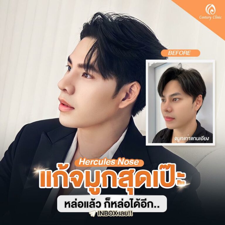 Century-รีวิว-แก้จมูก #792