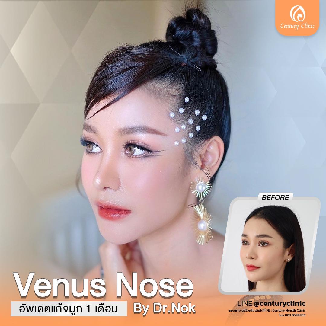 Century-รีวิว-แก้จมูก #796