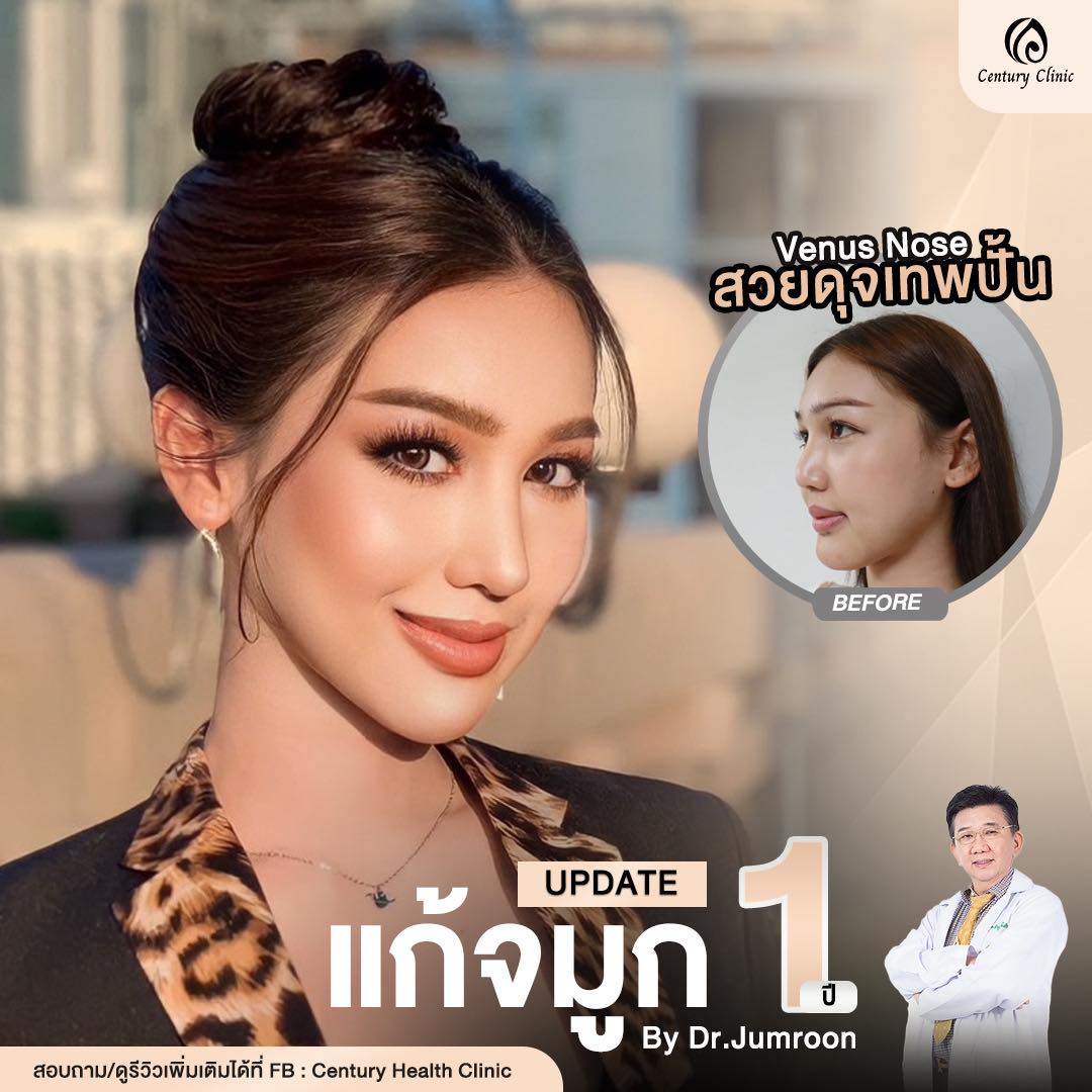 รีวิว แก้จมูก #797 , Century Clinic Thailand Century-รีวิว-แก้จมูก #797