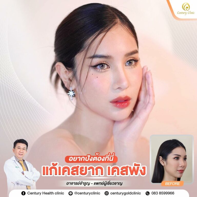 Century-รีวิว-แก้จมูก #806
