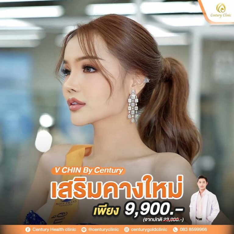 Review เสริมคาง #8
