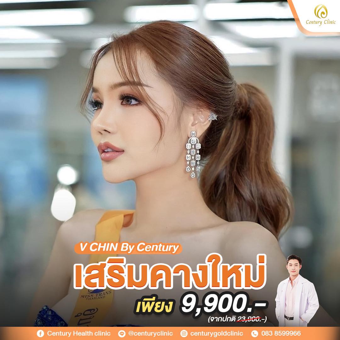 Review เสริมคาง #8