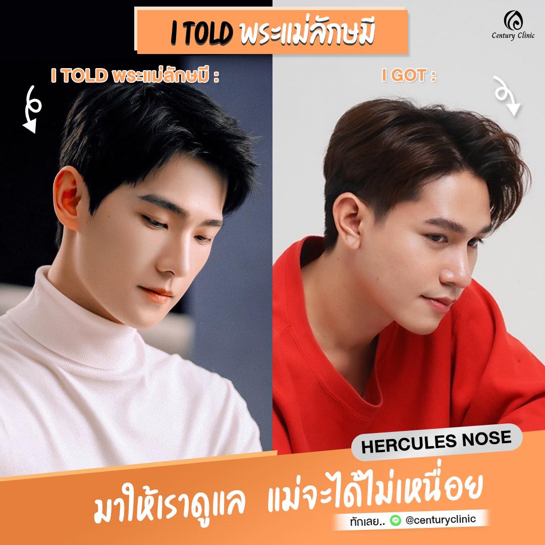 รีวิว เสริมจมูก#849