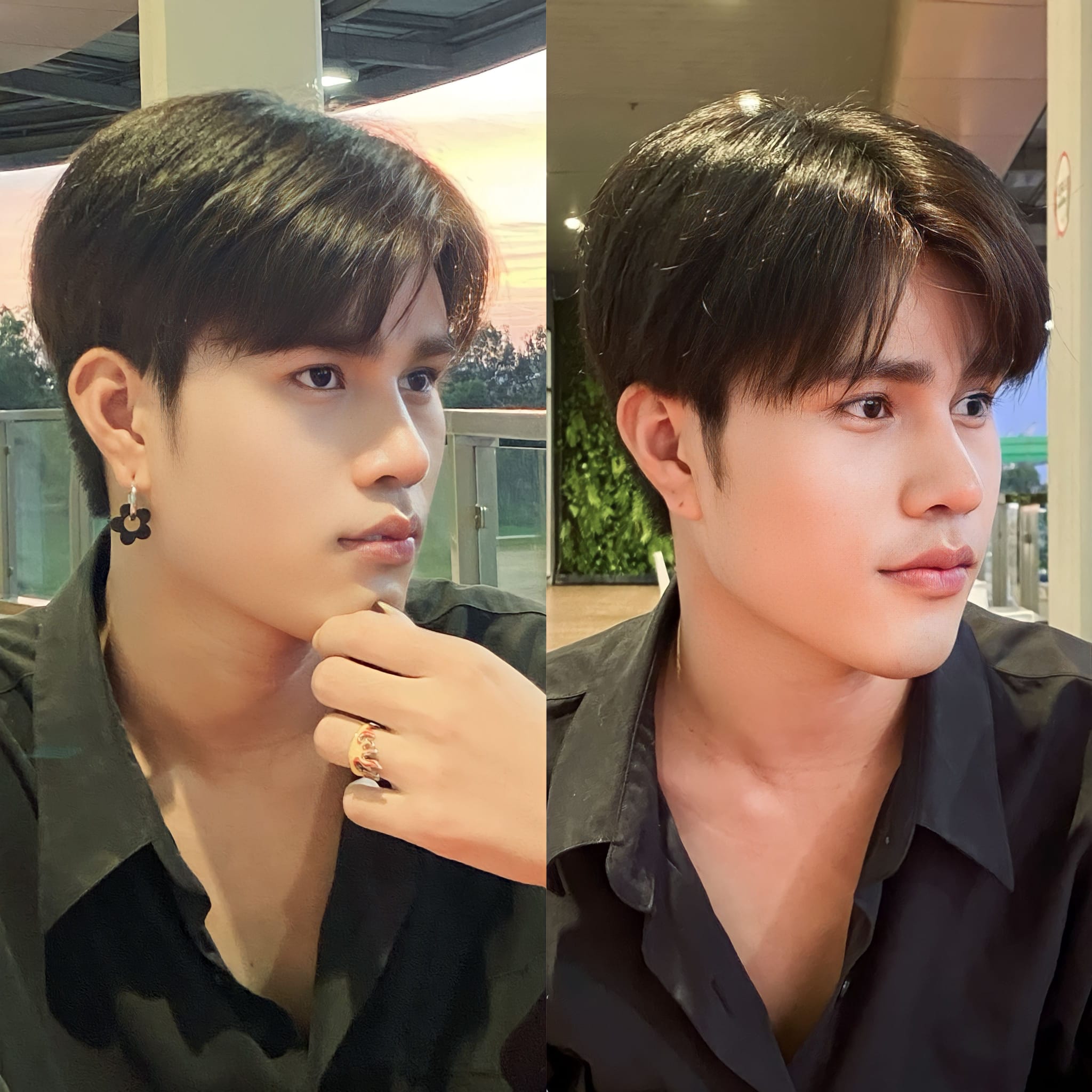 รีวิว เสริมจมูก#851