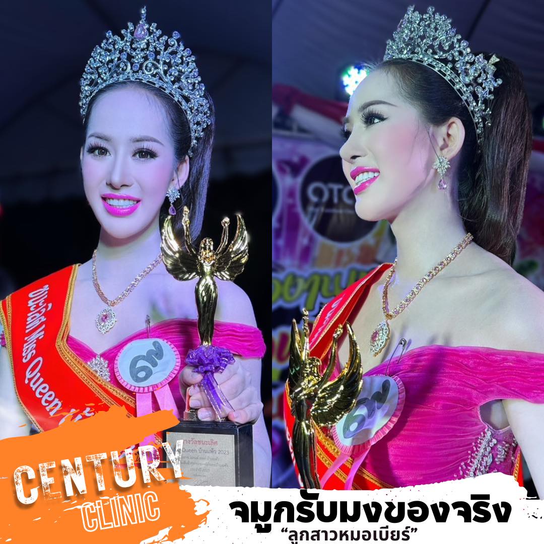รีวิว เสริมจมูก#853