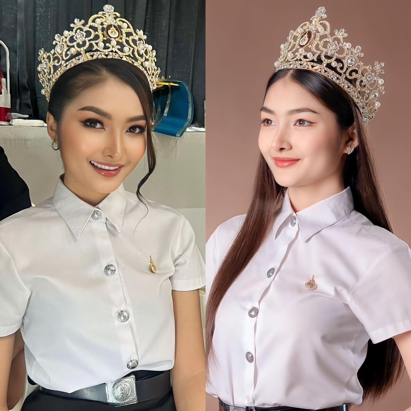 รีวิว เสริมจมูก#856
