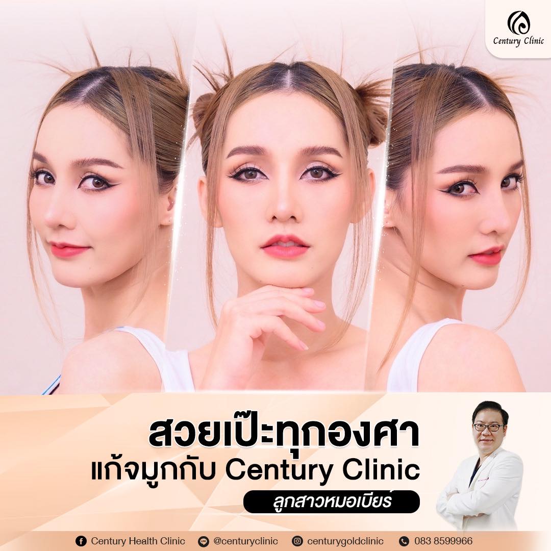 รีวิว แก้จมูก #831