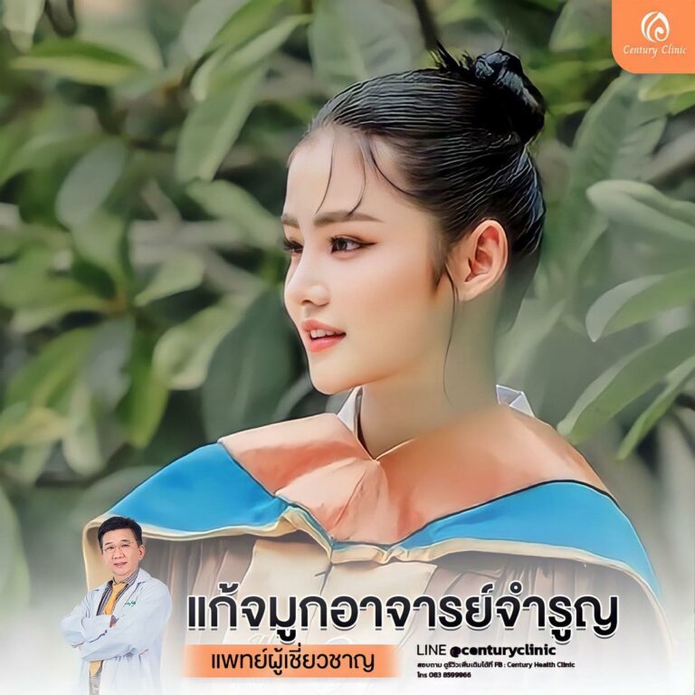 รีวิว แก้จมูก #835